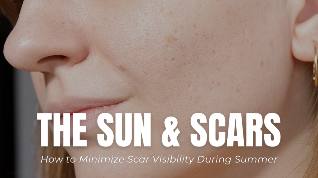 The Sun & Scars: How to Minimize Scar Visibility During Summer | Dr ...